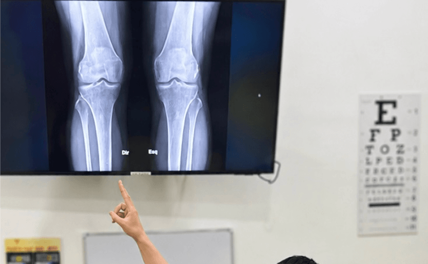 Knee Img 10