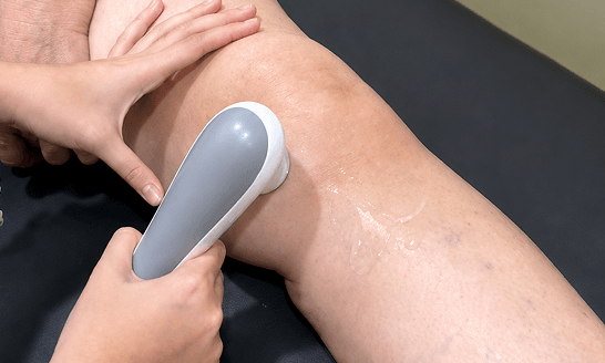 Knee Img 2