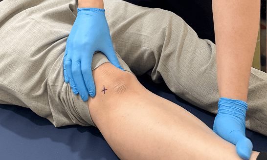 Knee Img 3